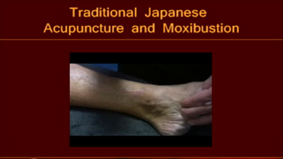 Prostate Inflammation&##x3a; Part 2