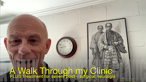 Treating Severe Chronic Neuralgia