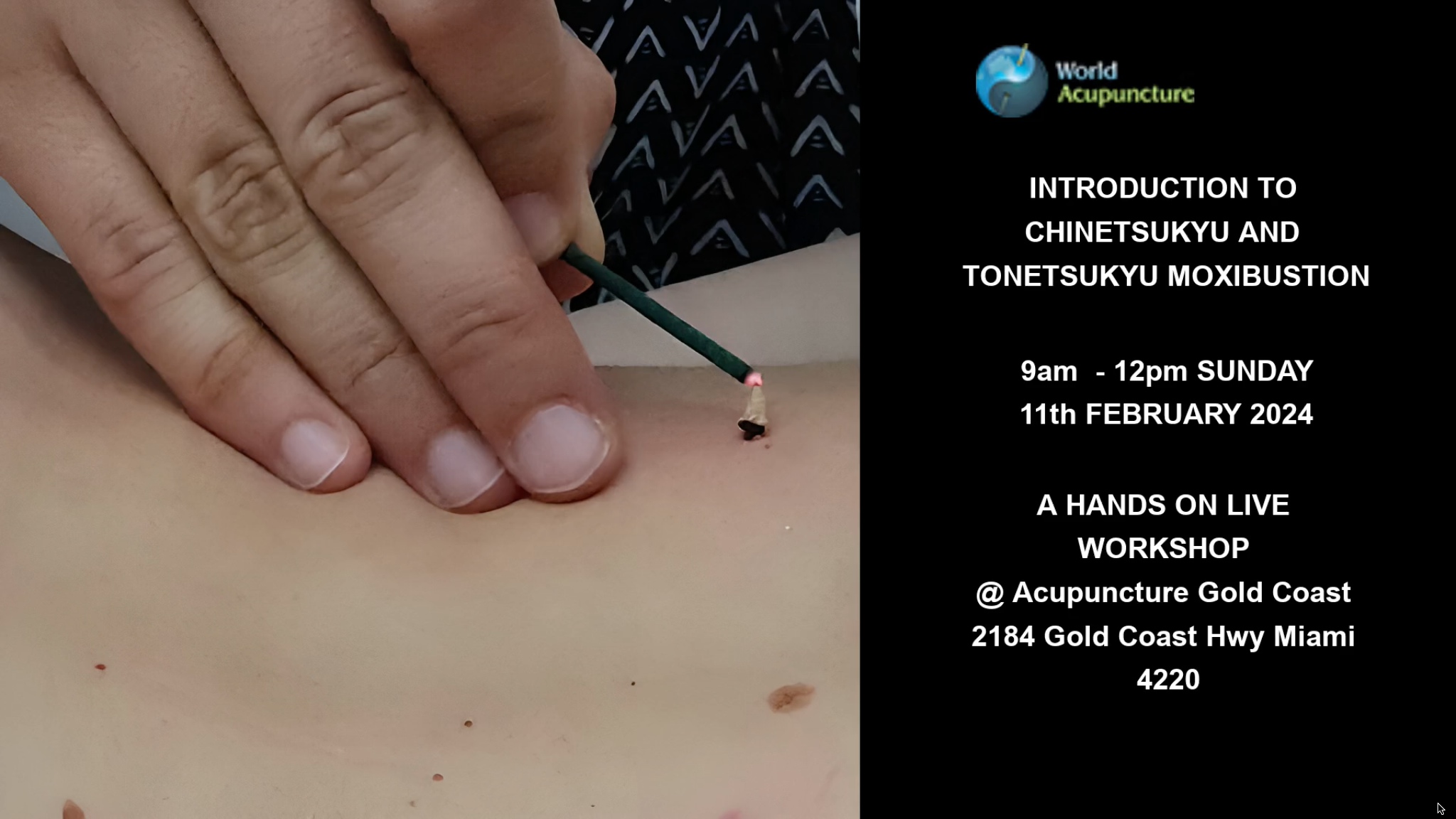 Introduction to Chinetsukyu and Tonetsukyu Moxibustion