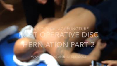 Post Operative Disc Herniation Part 2