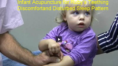 Treatment for Infant Teething and Disturbed Sleep